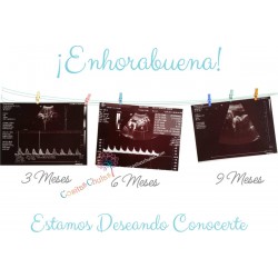 cuadro cositas chulas ecografía bebé